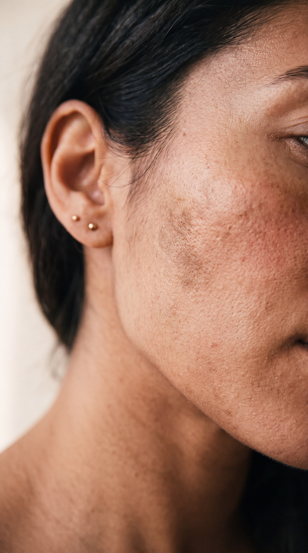 Skin before the test